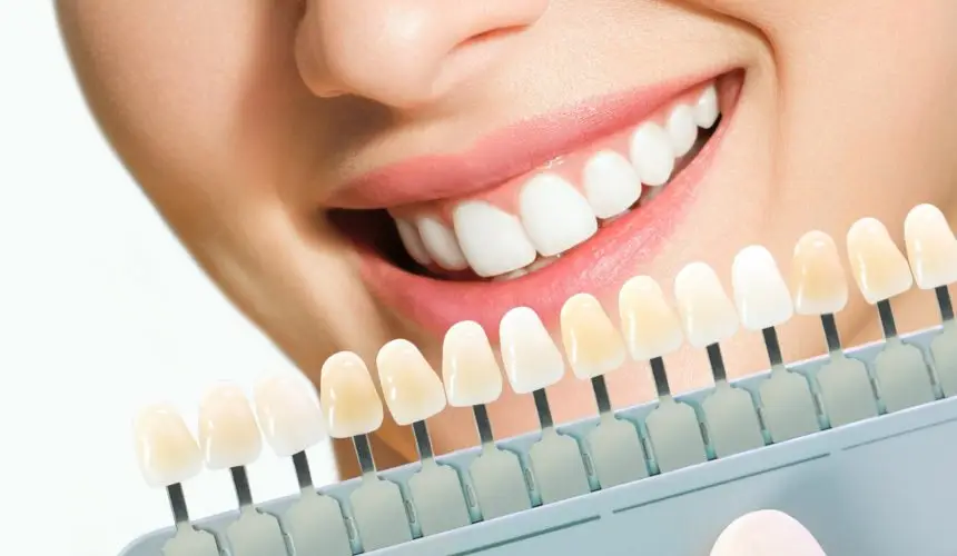 Woman with bright Hollywood Smile matching teeth shade guide in Turkey