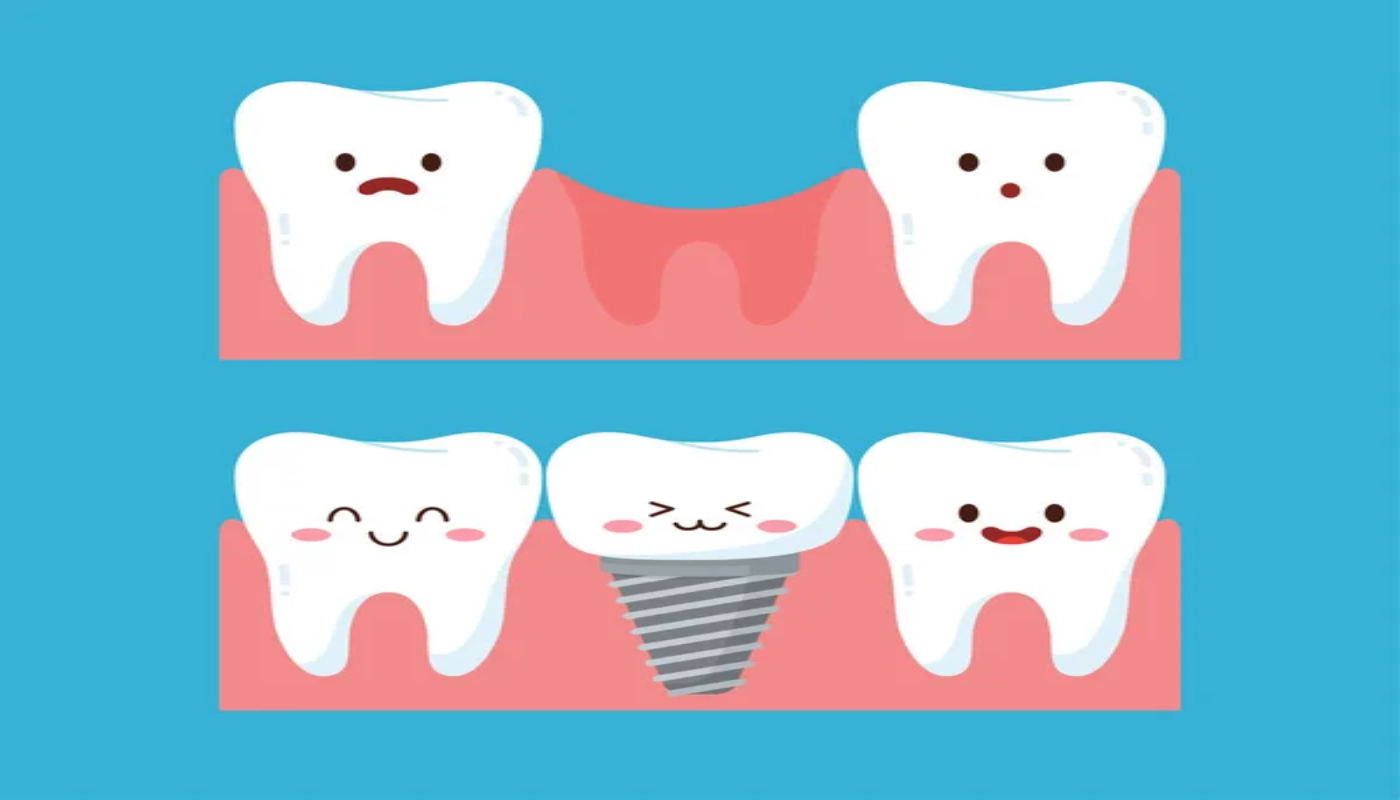 Illustration showing a sad missing tooth and a happy, restored tooth after a dental implant procedure