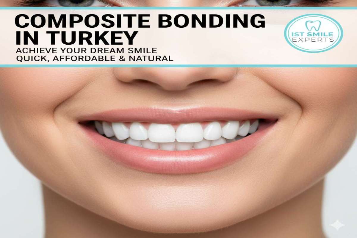 Smiling woman showcasing perfect, natural-looking teeth after composite bonding treatment, with text "Composite Bonding in Turkey"